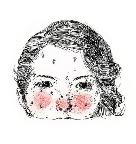 SNOflake