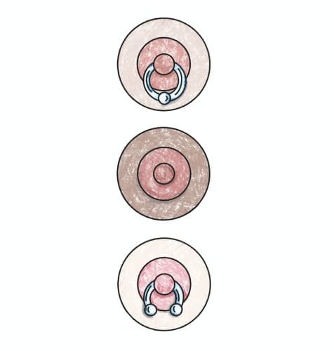 Triple Nipple